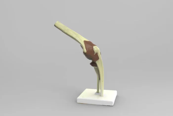 Anatomical Model of Elbow Joint, a preview image from Threeding